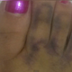 Image for article titled Woman Sees the Face of Jesus in Her Dirty Messed Up Toe